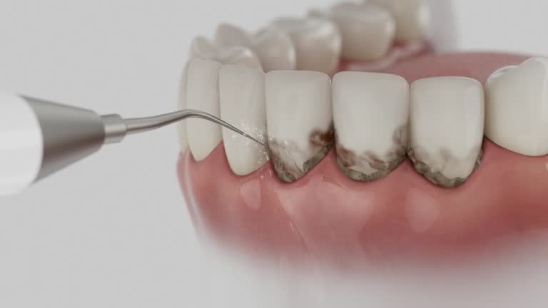 Trusted Dental Crowns And Bridges service in Tuntutuliak, AK - Dentist Open Now